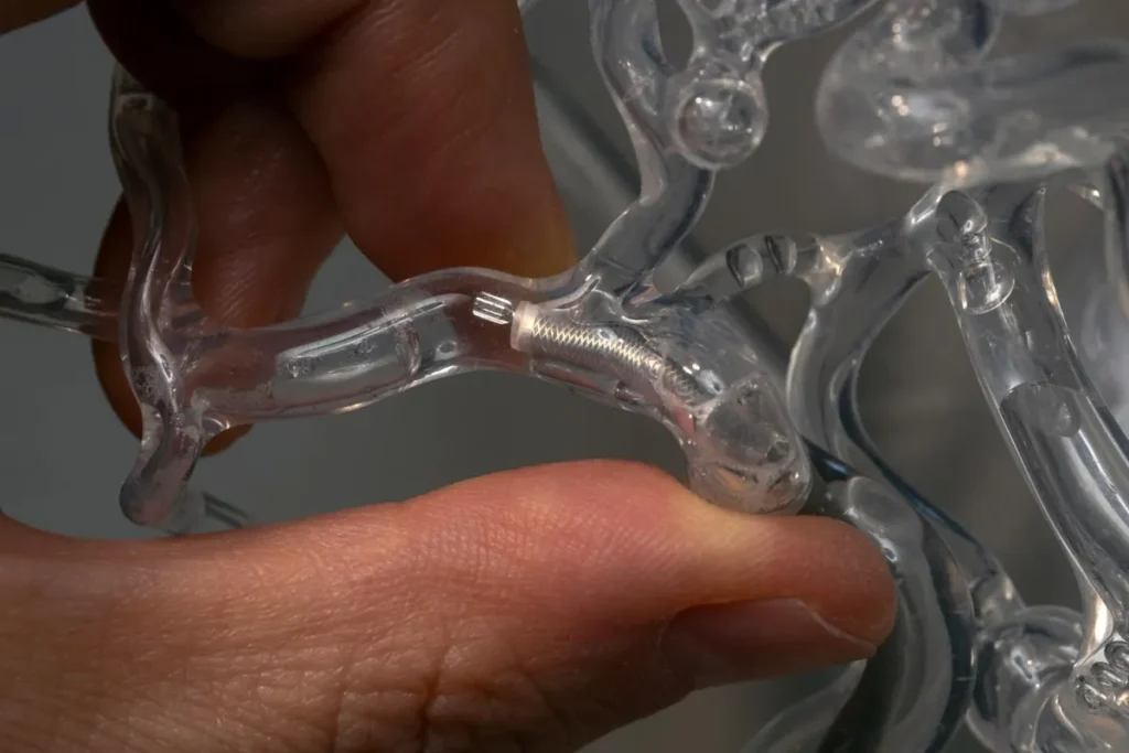 O milispinner consegue desobstruir vasos muito pequenos e delicados com alta precisão • Andrew Brodhead/Universidade de Stanford